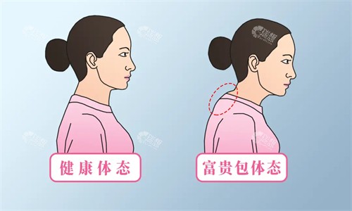 富贵包素材图