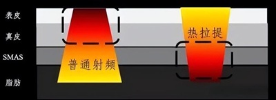 热拉提